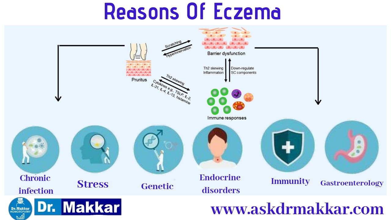Reason of eczema